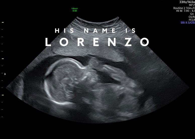 His Name Is Lorenzo - Zod & Drea